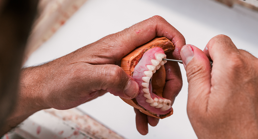 blog-signs-dentures-need-reline